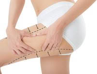 Plastic Surgery to reshape and enhance including tummy tuck and liposuction