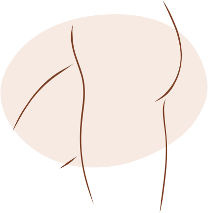 Thigh Lift